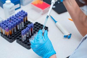 lan tach running tests on blood 